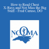 Fred Caruso - How to Read Chest X-Rays and Not Miss the Big Stuff - Fred Caruso
